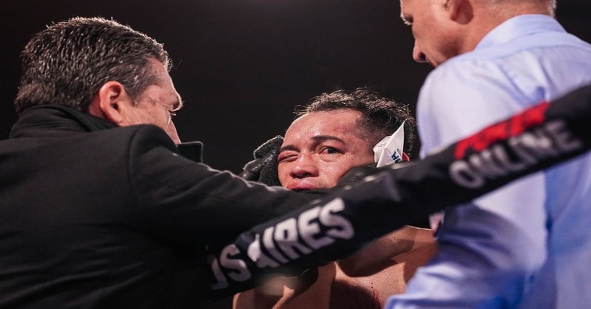 Nonito Donaire, la leyenda del boxeo, hizo historia en su paso por Argentina. Foto: Boxeo de Primera
