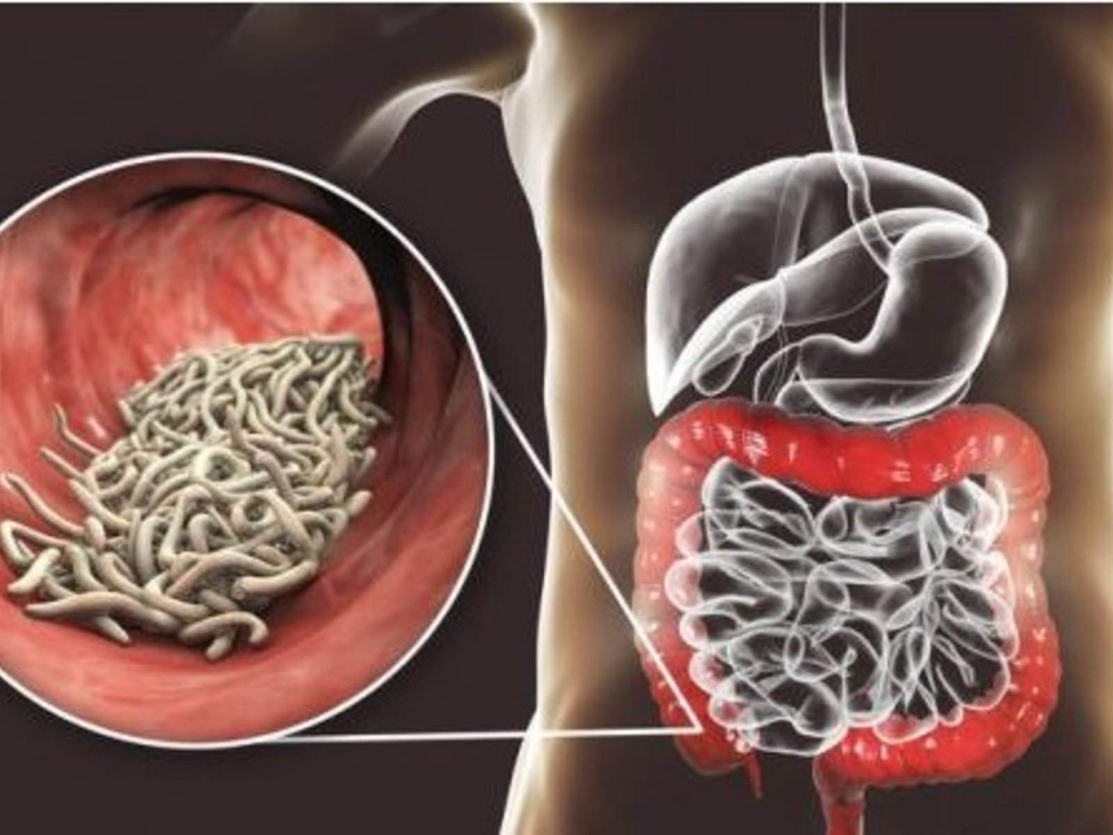 Detectando los inquilinos ocultos: un llamado a la atención sobre la salud intestinal La salud intestinal es un pilar fu... Descubre más sobre encontrarse, s...