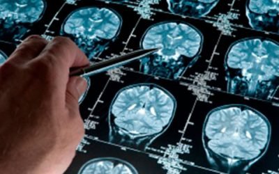 Alzheimer en El Cronista, Información General