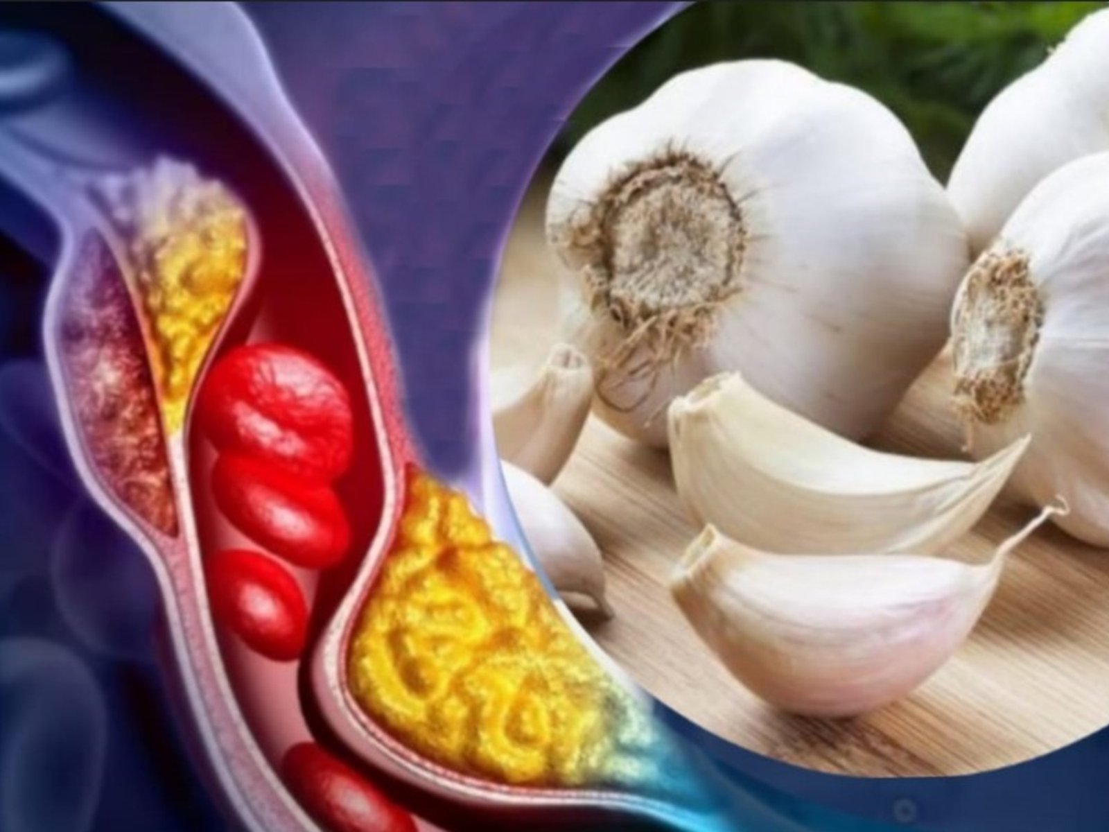 Según la Organización Mundial de la Salud (OMS), el consumo moderado de ajo puede contribuir a reducir la presión arterial y los niveles de colesterol, dos factores clave para prevenir enfermedades cardíacas.