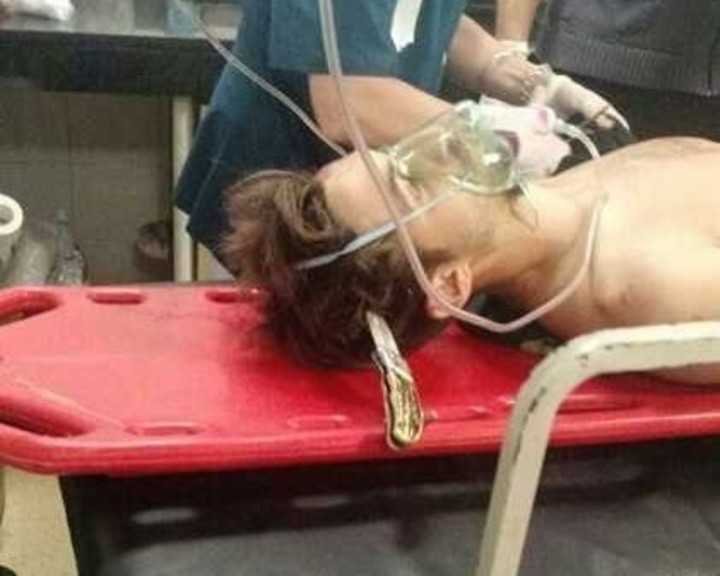 Mariano Bonetto apuñaló y mató a dos jóvenes en la Plaza Irala de La Boca, y quedó con el arma blanca clavada en su cabeza.