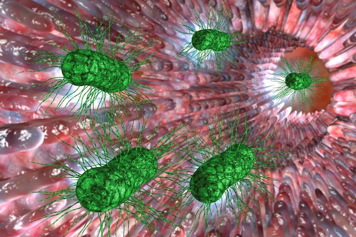 SIBO: se trata de un aumento de las bacterias en el intestino delgado