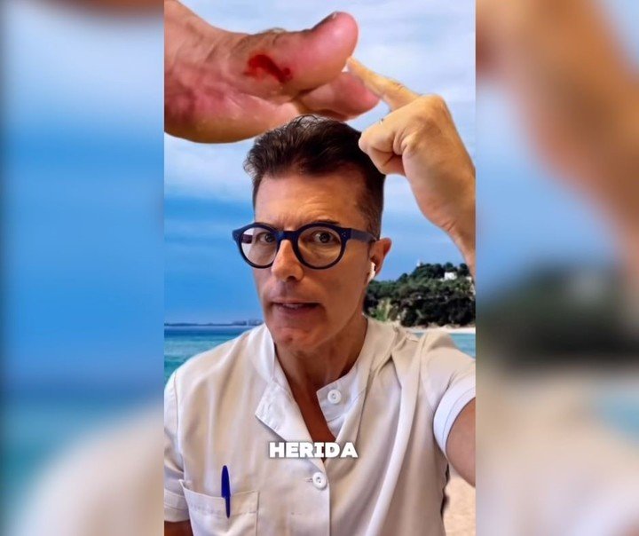 El médico Manuel Viso, en un video sobre las heridas y el efecto del agua de mar. Foto: captura de video/@manuelvisothedoc.