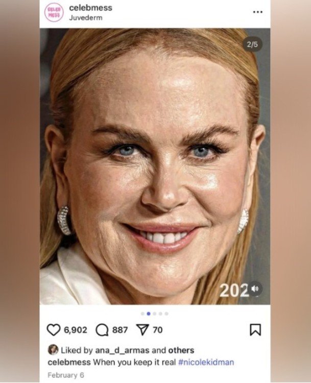 El polémico 'me gusta' de Ana de Armas a un post que criticaba la apariencia de Nicole Kidman, la exesposa de Cruise. Foto: IG @celebmess
