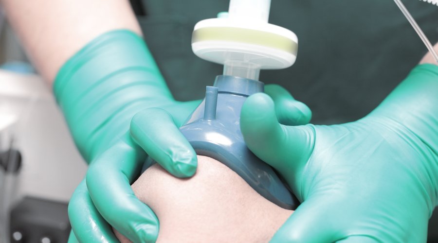Imagen relacionada con Anestesia dental: UBA introduce el óxido nitroso para mejorar la sedación en odontología.
