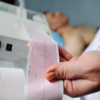 Un nuevo dato sobre los infartos cambia una creencia y confirman que una droga usada para otra cosa los evita