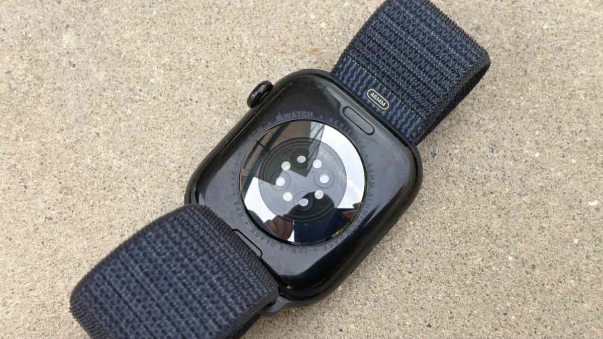 10 Features That Would Make Me Buy the Apple Watch Series 11